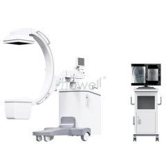 Mobile C-Arm X-Ray System
