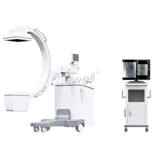 Mobile C-Arm X-Ray System