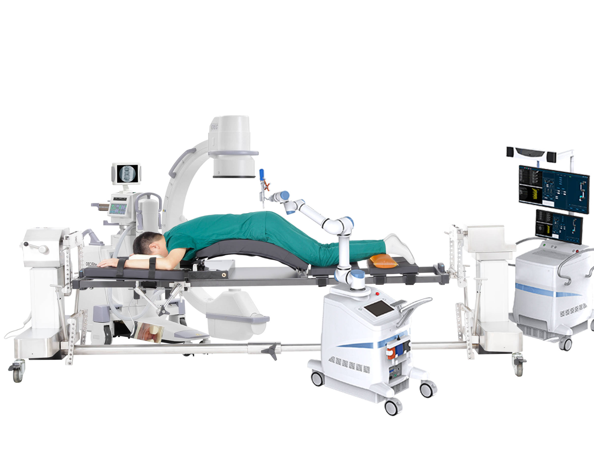 ¿Qué tipo de cama operatoria es adecuada para el sistema de posicionamiento y navegación quirúrgica?