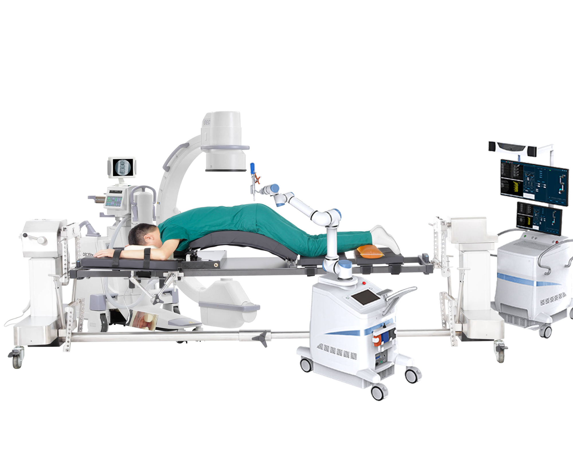 What kind of operating bed is suitable for surgical navigation and positioning system?