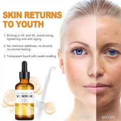 Vitamin C serum