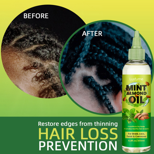 hair scalp oil