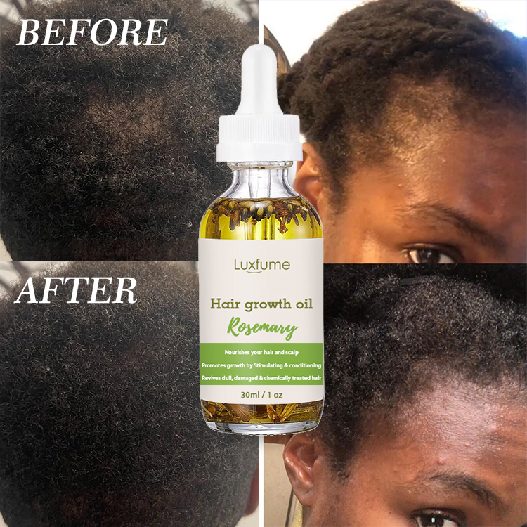 Rosemary Oil