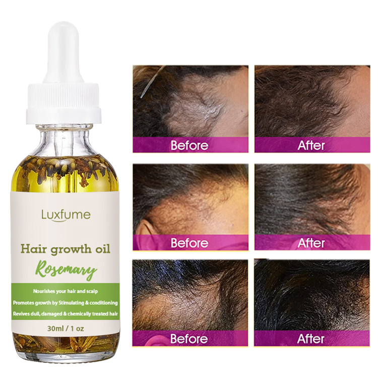 Rosemary Oil