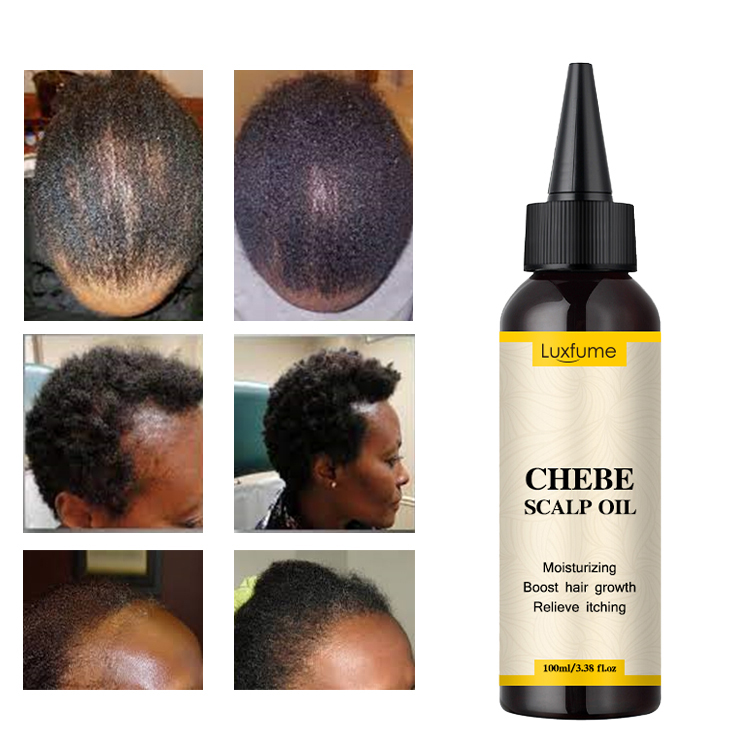 Chebe Scalp Oil