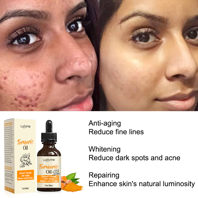 Turmeric Oil