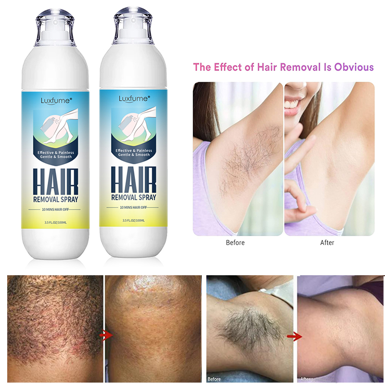 Hair Removal Spray