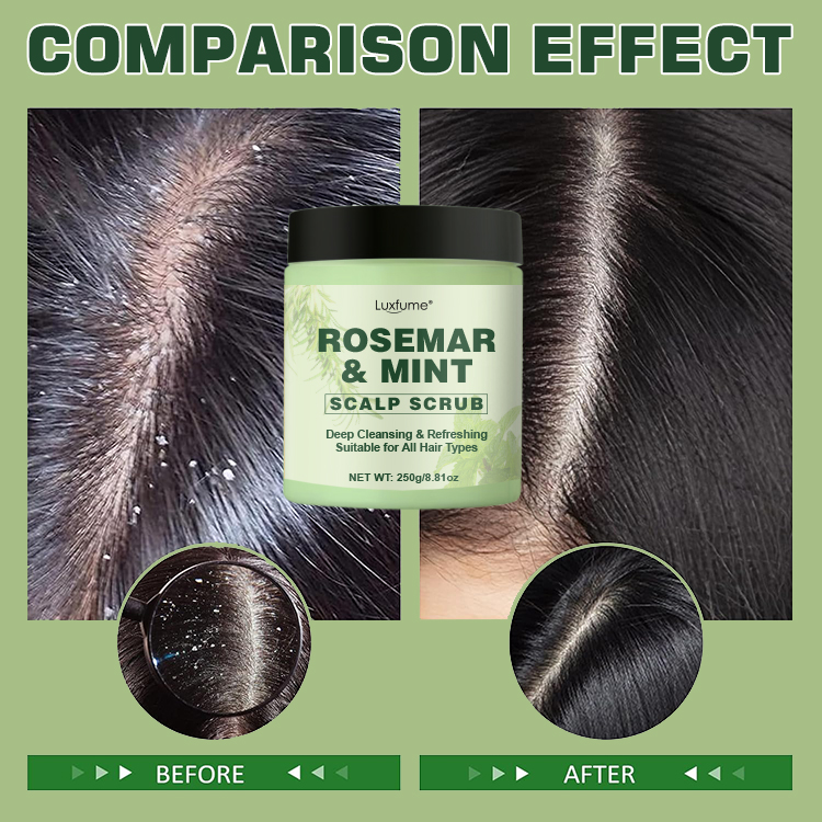 Rejuvenate your scalp and restore your hair's shine: The power of scalp scrubs