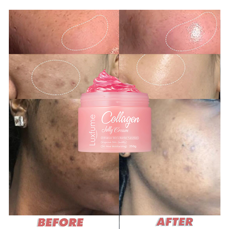 Collagen Jelly Cream