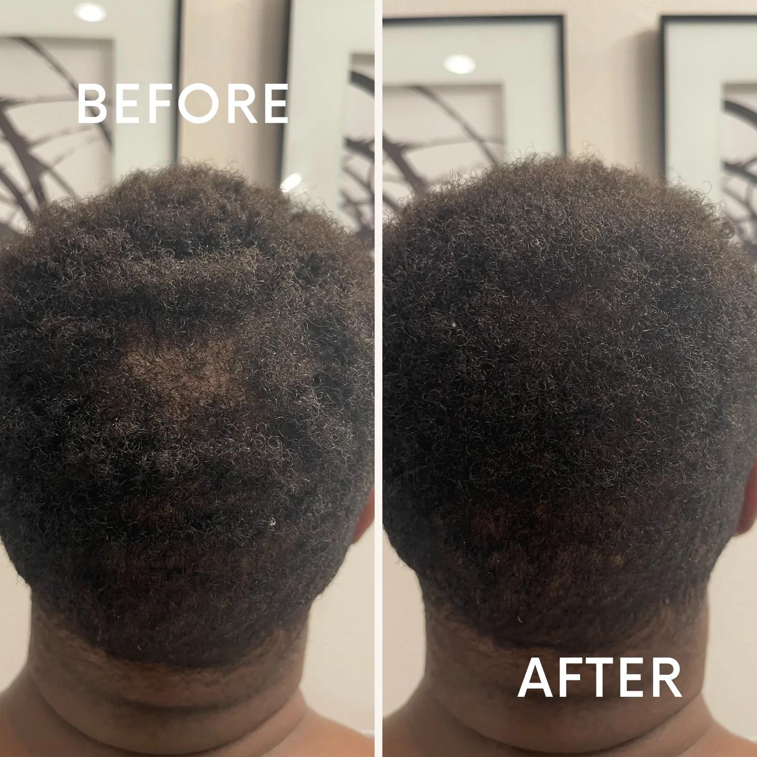 Chebe Hair Growth Set