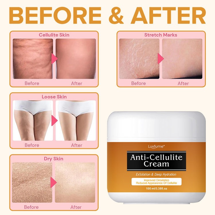 Anti Cellulite Cream