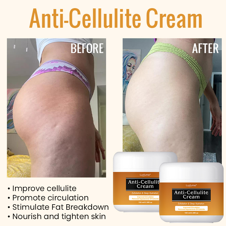 Anti Cellulite Cream