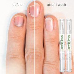 Nail Cuticle Oil Pen