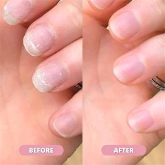 Nail Cuticle Oil Pen