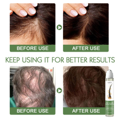 Rosemary Hair Growth Serum