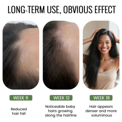 Rosemary Hair Growth Serum