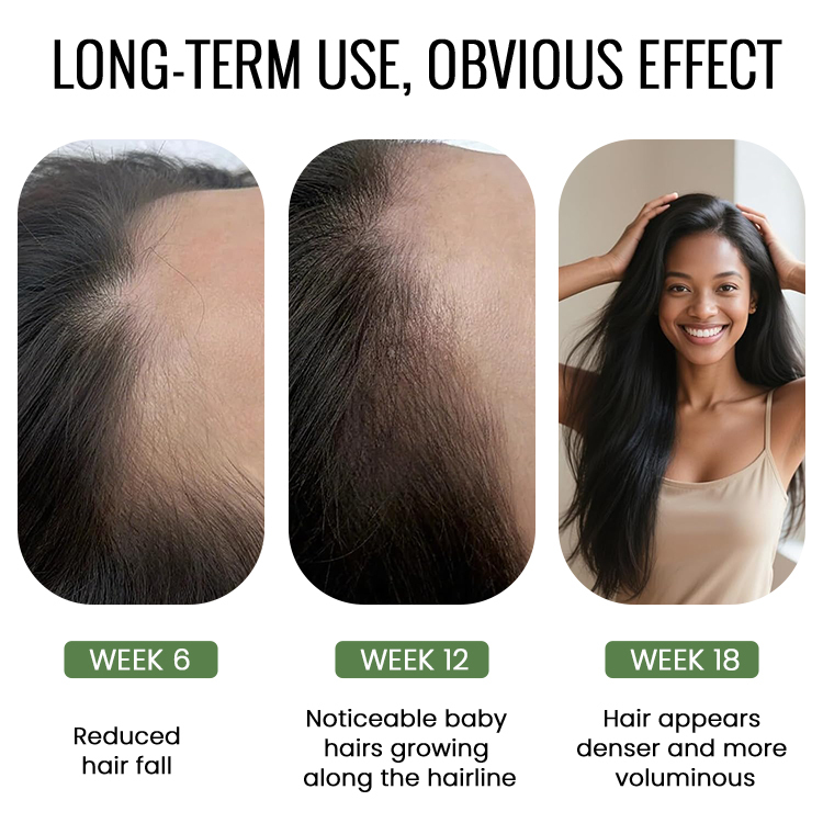 Rosemary Hair Growth Serum