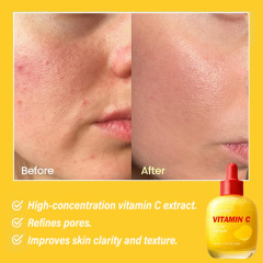 Vitamin C Glow Serum