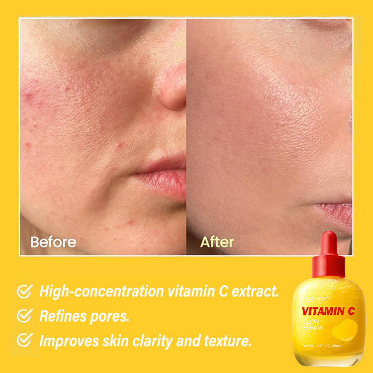 Vitamin C Glow Serum