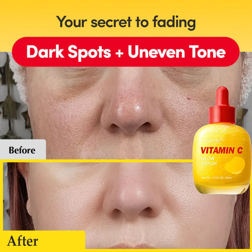 Vitamin C Glow Serum