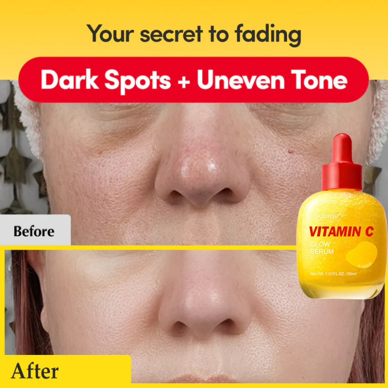 Vitamin C Glow Serum