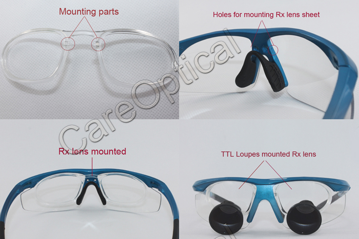 Custom Made TTL Dental Surgical Loupes 2.5x 3.0x 3.5x with Sports frames