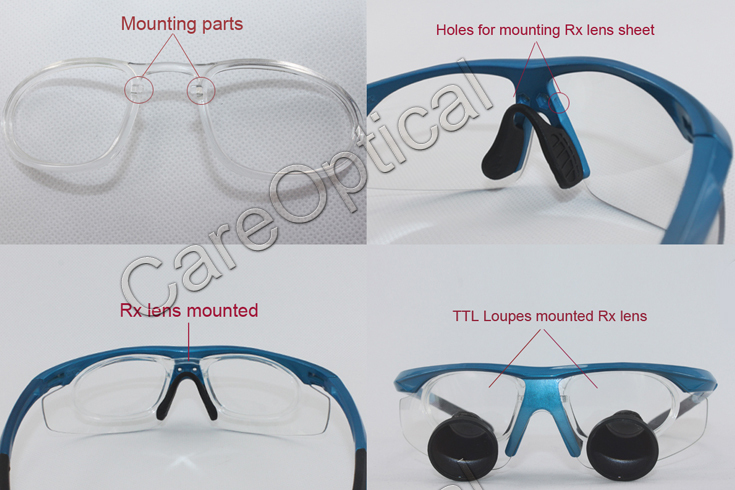 TTL Dental Loupes Surgical Loupes 2.5x 3.0x 3.5x Sports frames CHL series WIth Light CHL-JCM-08P-CP