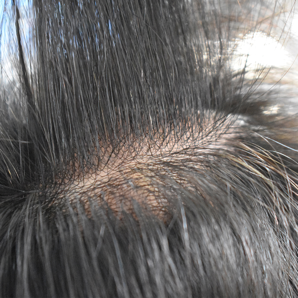 Silk Base Center Clear PU Around Hair System For Men SAP