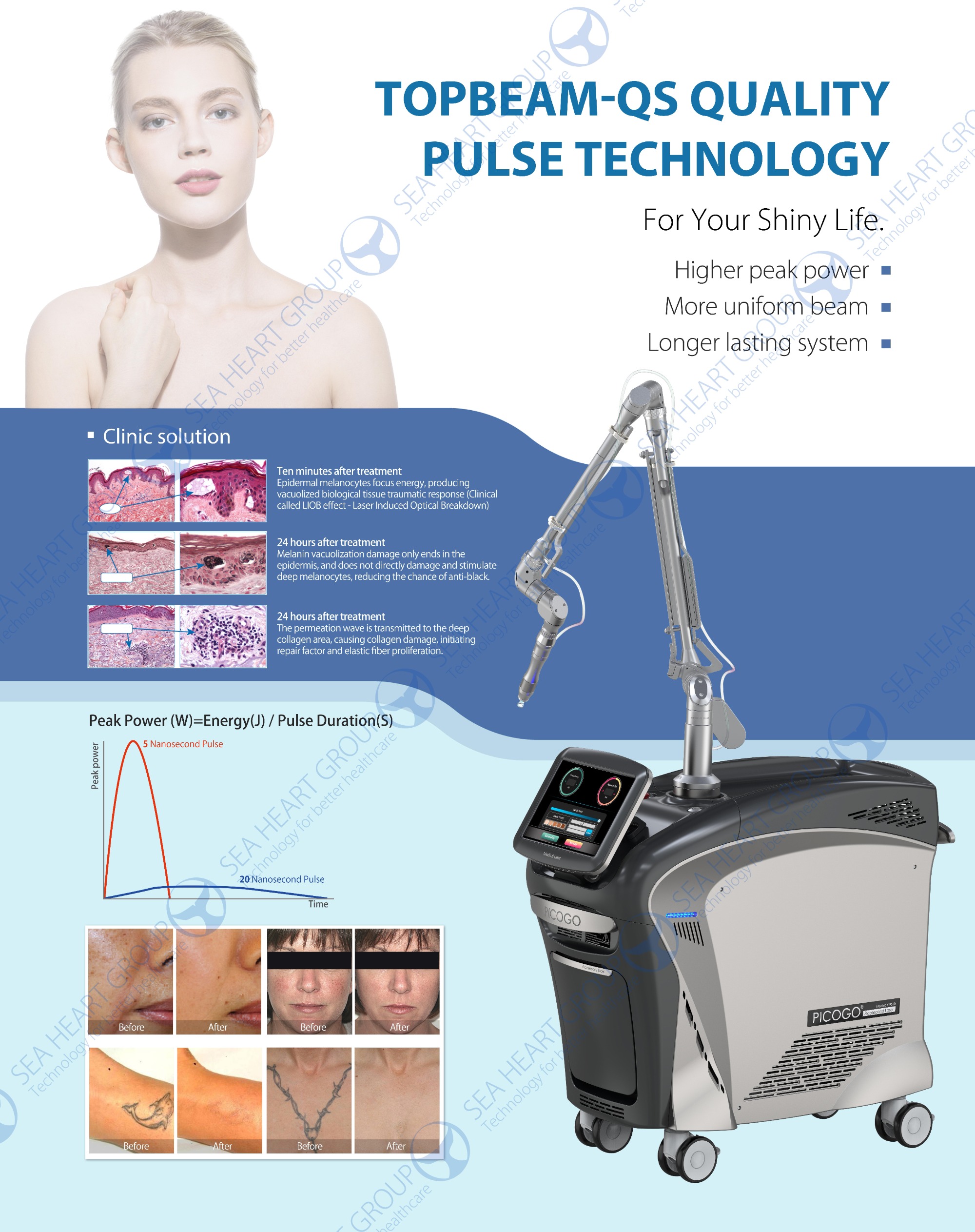 picosecond laser 