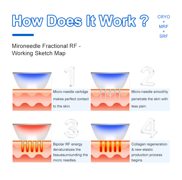 Microneedling RF Machine