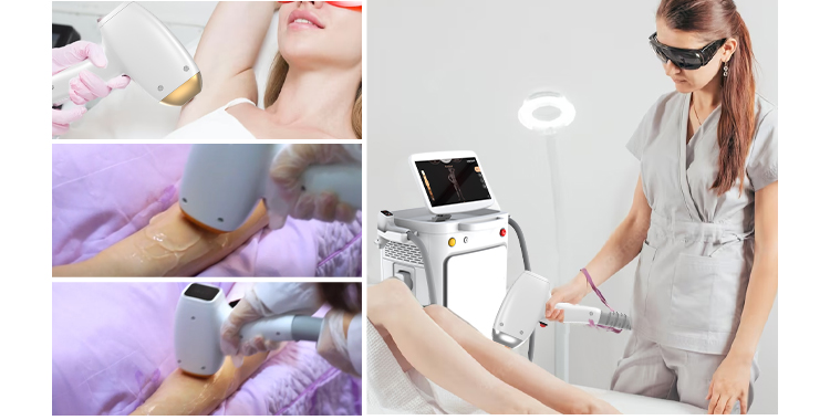 laser hair removal machine price