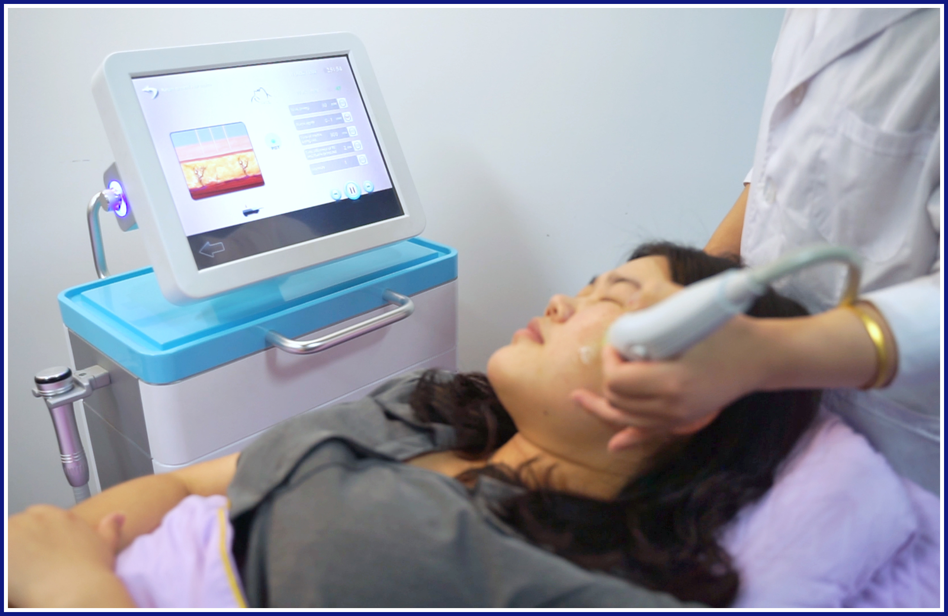 Watch the Ultimate RF Microneedle Machine in Action!