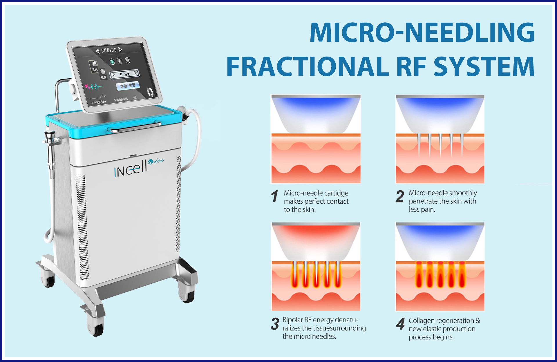 Unlocking the Power of Professional Aesthetic Radiofrequency Technology