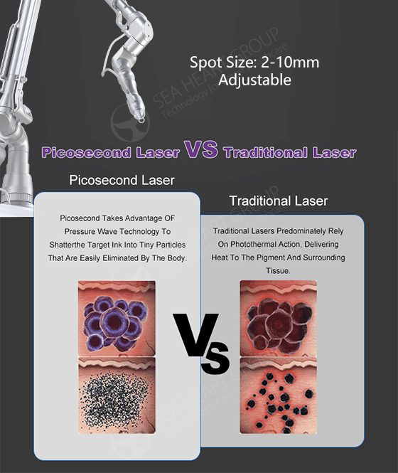 working mechanism of Q-Switched Nd: YAG Laser and Picosecond Laser.