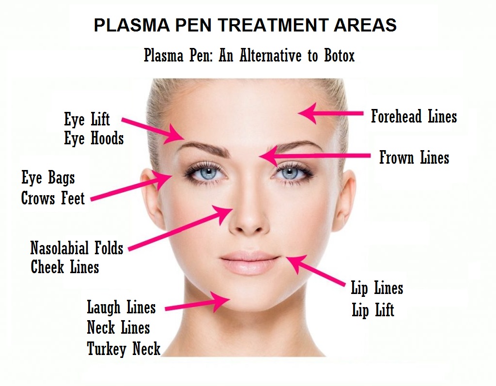 plasma pen treatment areas