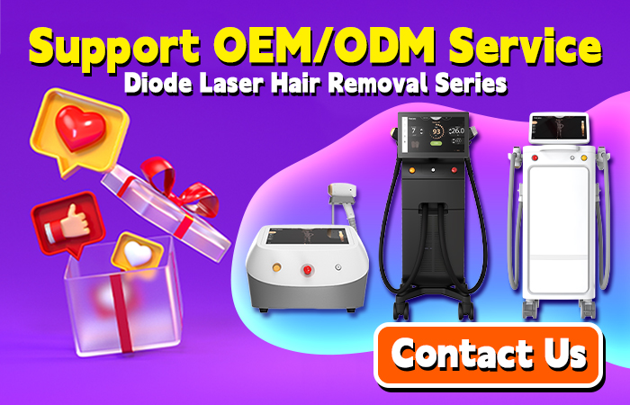 epilation diode laser