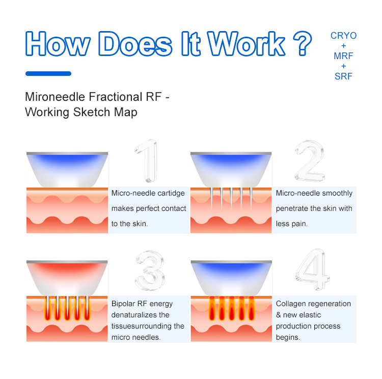 rf microneedling machine