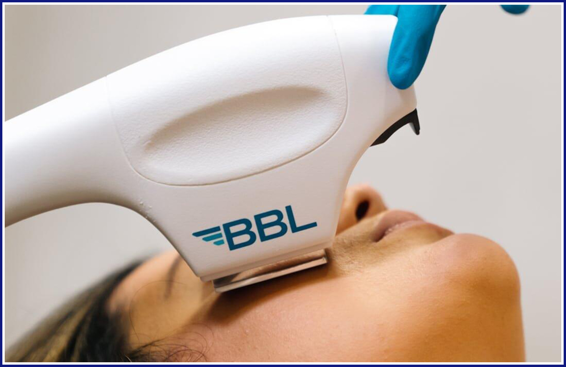 What Is A BBL Device And How Does It Work SEAHEART GROUP
