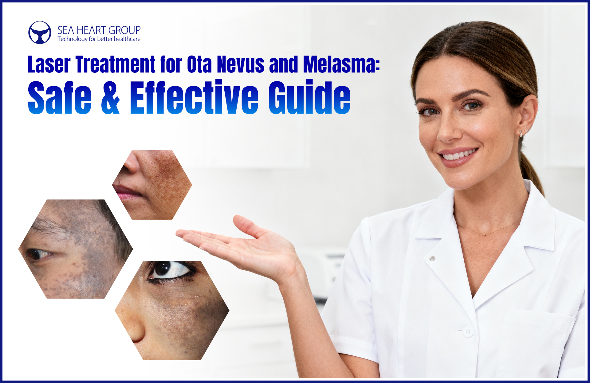 Laser Treatment for Ota Nevus and Melasma: Safe & Effective Guide