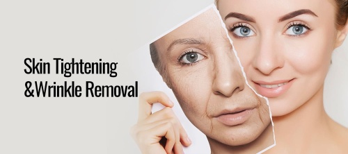 Skin Tightening&Wrinkle Removal
