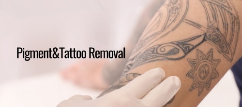 Pigment&Tattoo Removal