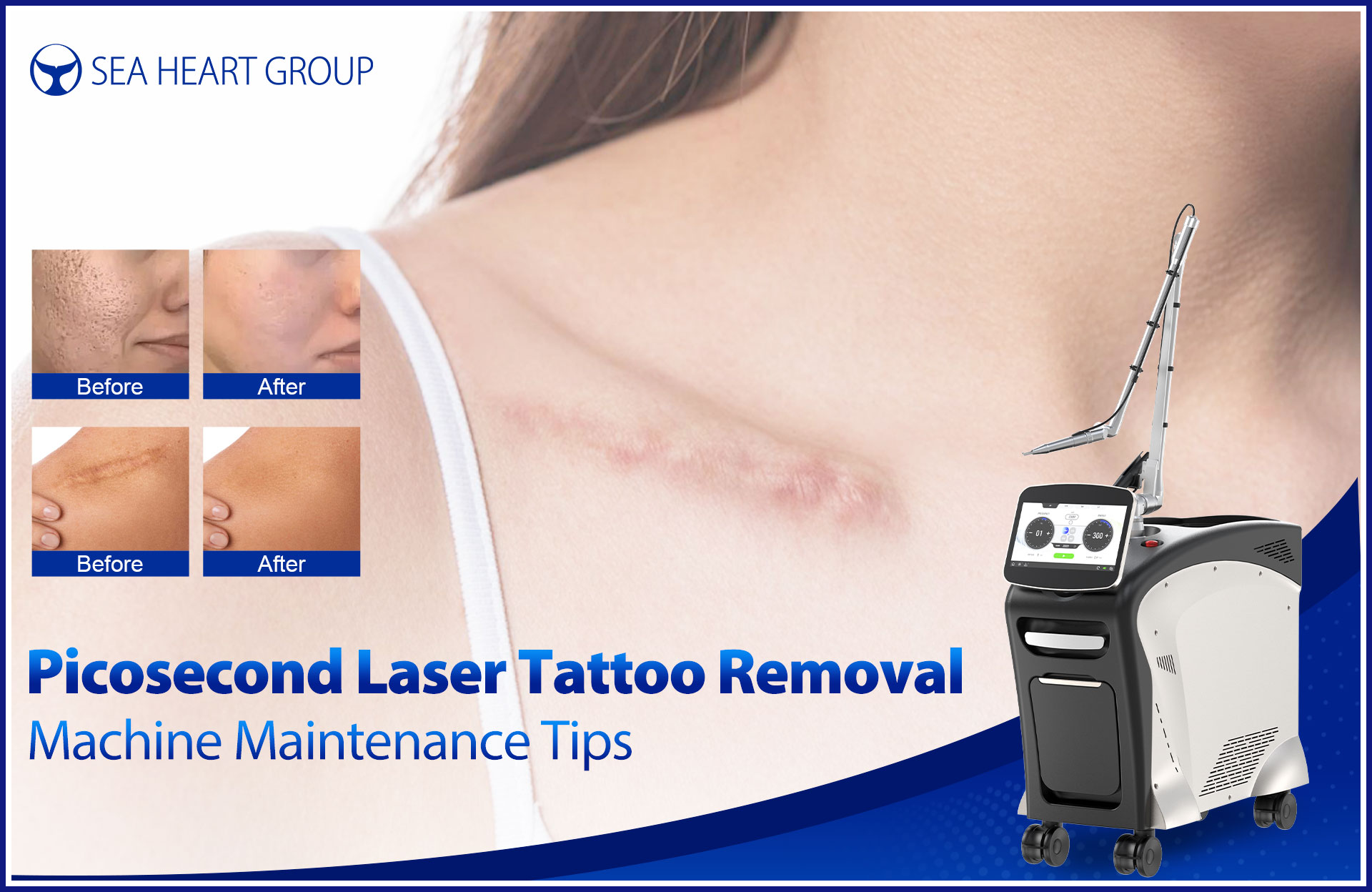 Picosecond Laser Tattoo Removal Machine Maintenance & User Guide
