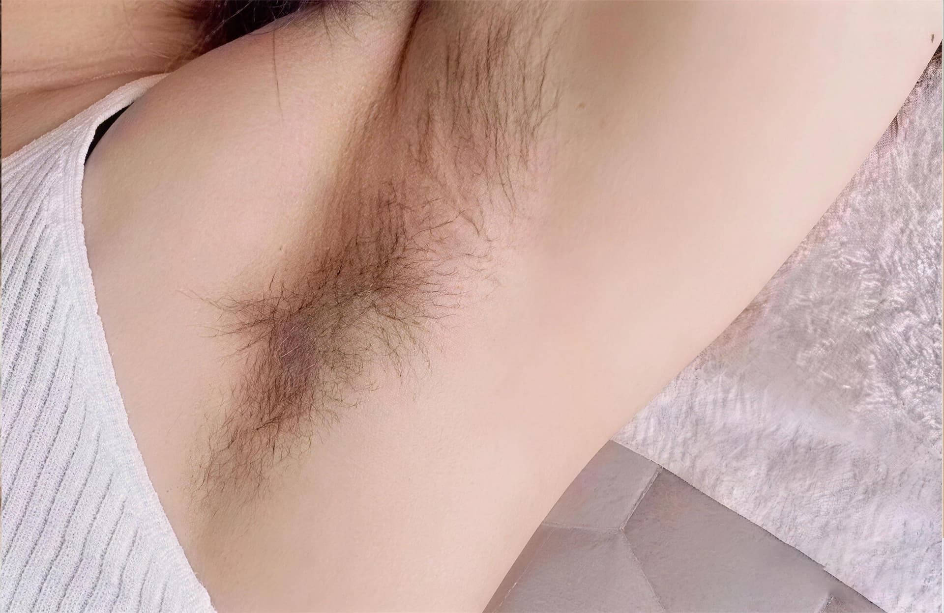 Before laser hair removal