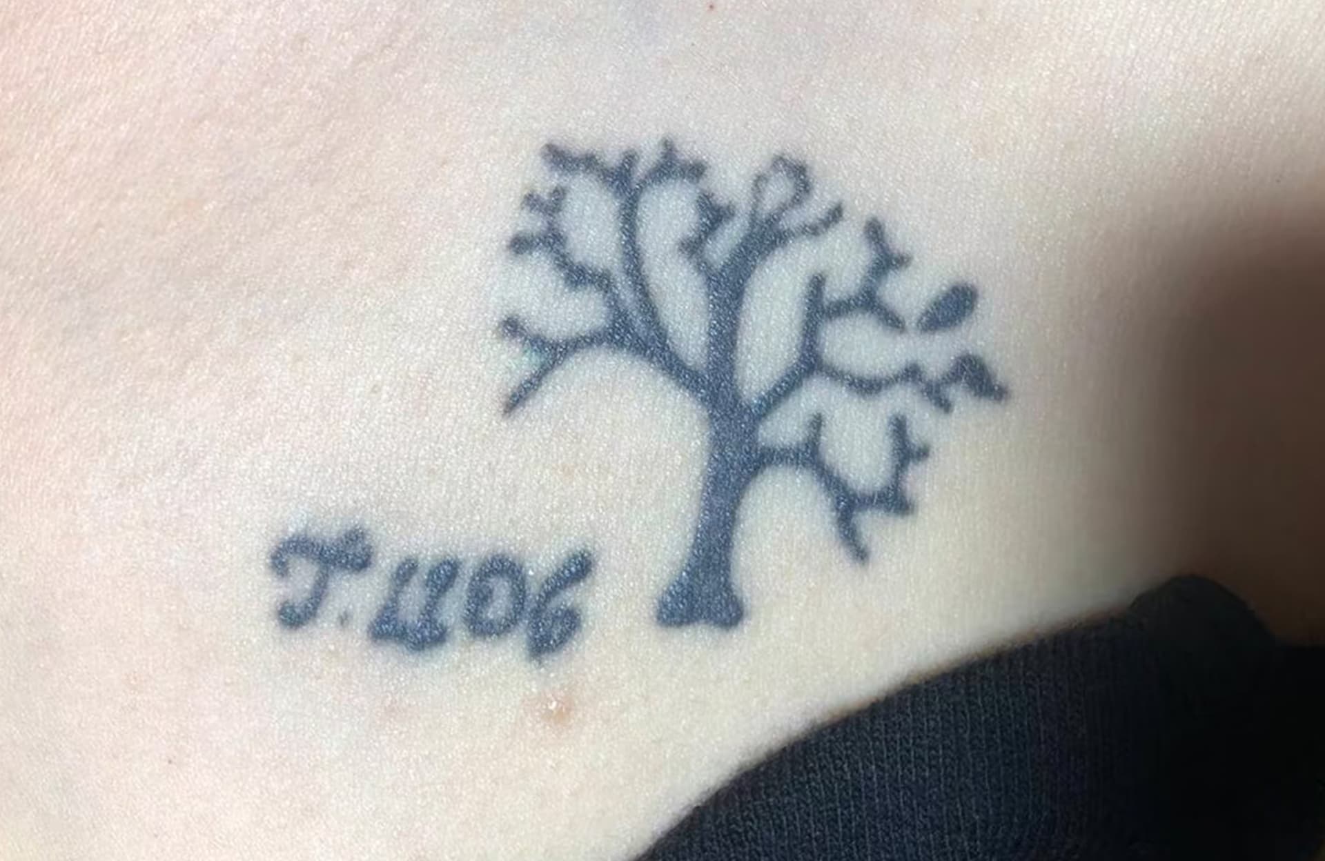 Before tattoo removal