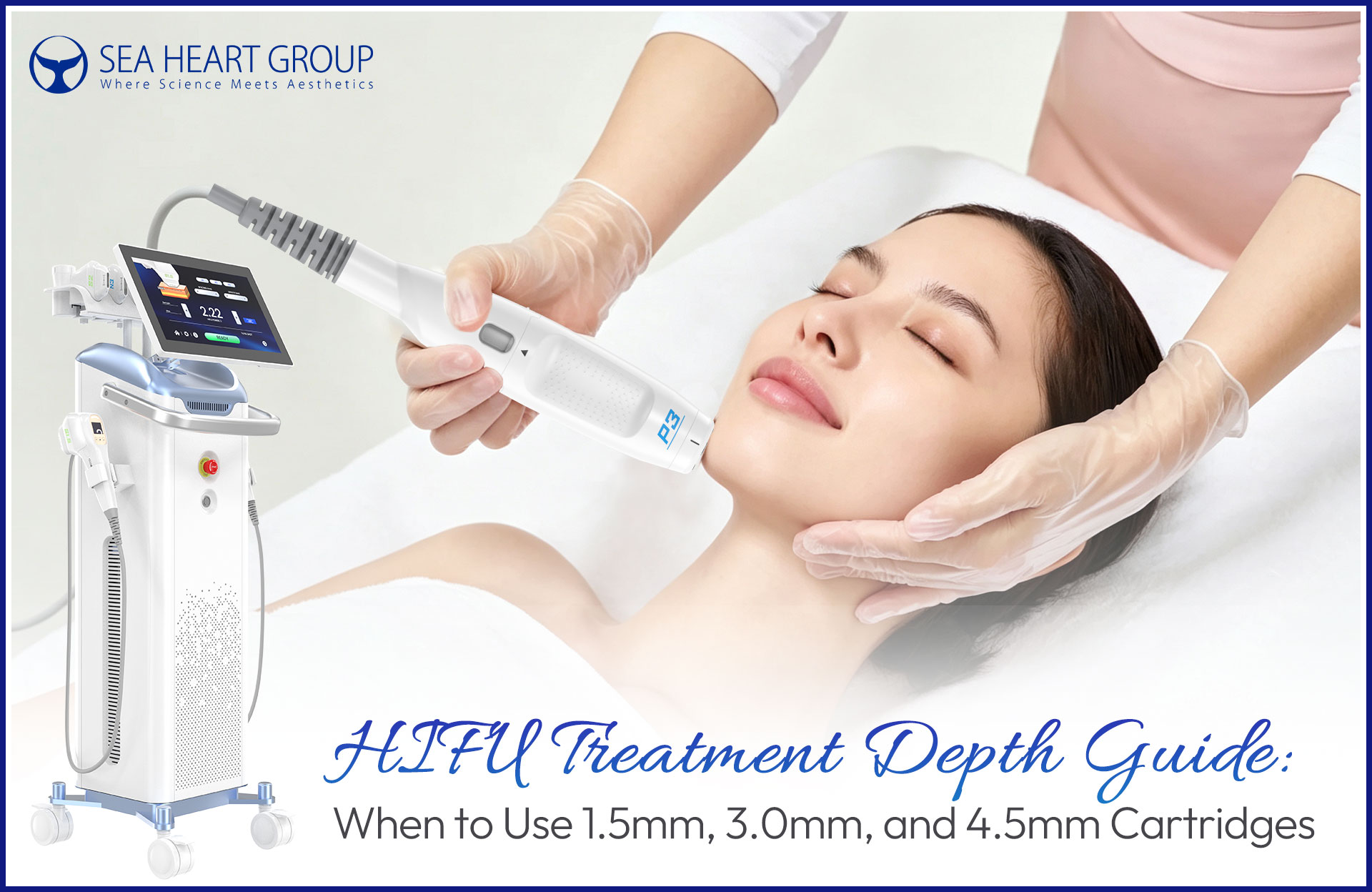 HIFU Treatment Depth Guide: When to Use 1.5, 3.0, and 4.5mm Cartridges
