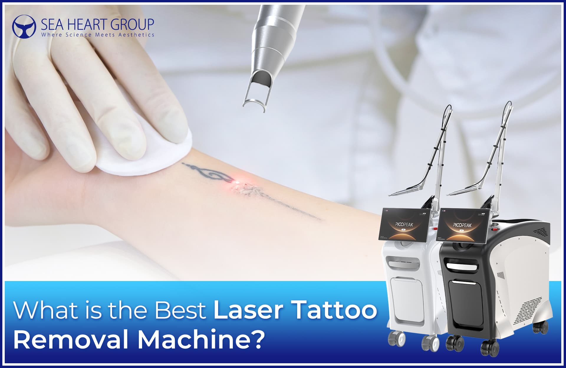 What is the Best Laser Tattoo Removal Machine?