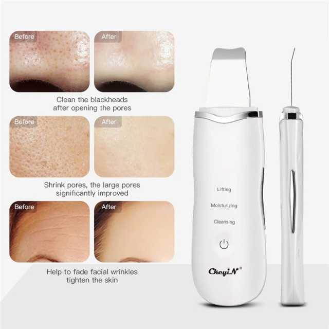 EMS Mesotherapy RF Radio Frequency Facial Beauty Ultrasoic Skin Cleaning Infrared Body Slimming Massager