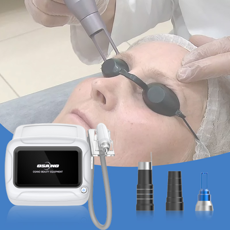 New Picosecond 1064nm 532nm Q-Switch Nd Yag Laser Pico Laser Tattoo Removal Machine