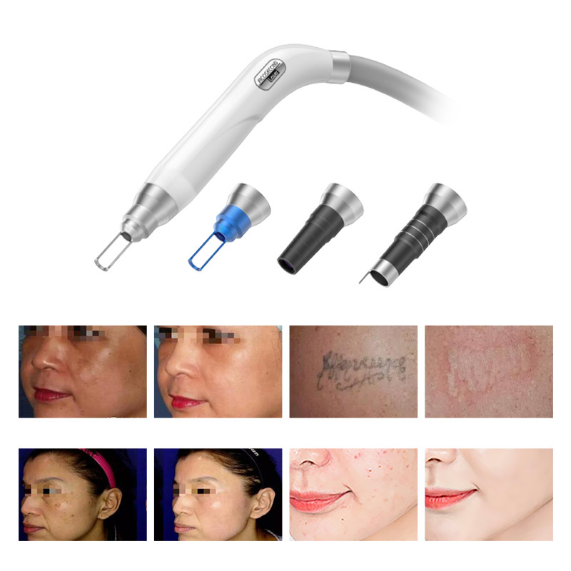 New Picosecond 1064nm 532nm Q-Switch Nd Yag Laser Pico Laser Tattoo Removal Machine