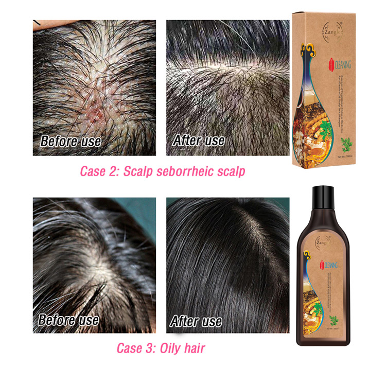 Natural Herbal Grow Shampoo Kit